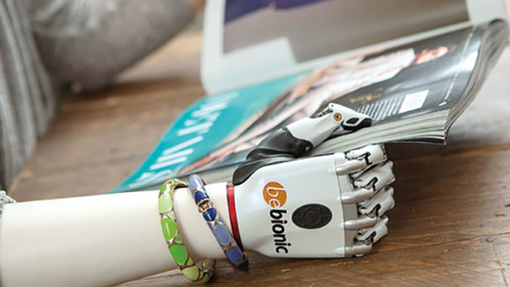 Bebionic Myoelectric Hand Prosthesis - Today's Medical Developments