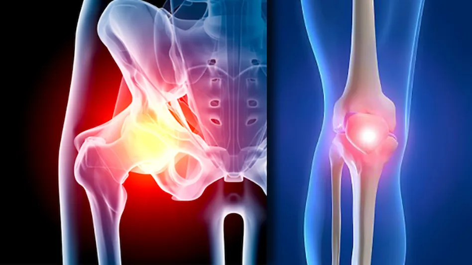 Hip and Knee Joint Replacement Surgery: How Is It Done