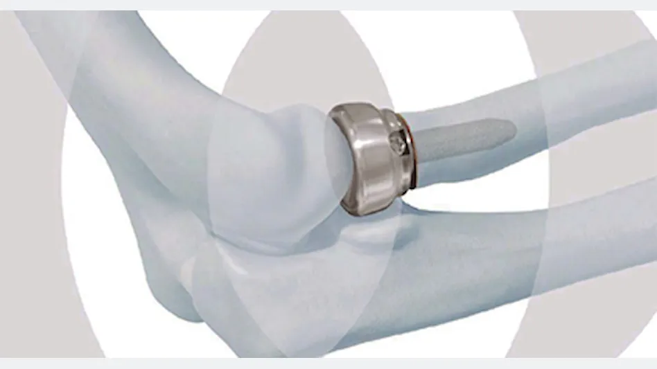 Radial Head Replacement System, DePuy Synthes