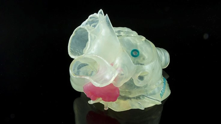 Model of patient's left atrial appendage (LAA) created with Stratasys and Materialise technology is intended to allow surgeons to select the appropriate device and plan the optimal approach to occlude the LAA.