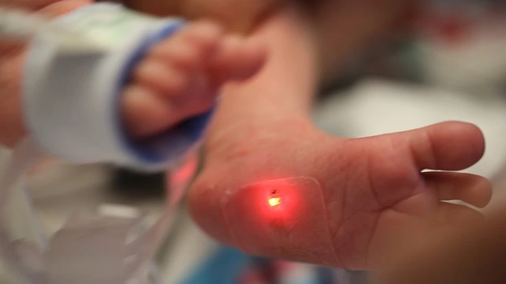 A wireless sensor on the foot of a baby in the NICO