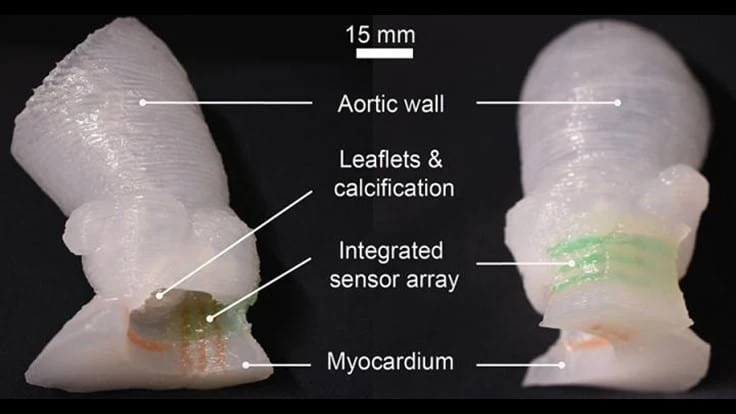 Patient-specific organ models, which include integrated 3D-printed soft sensor arrays, are fabricated using specialized inks and a customized 3D printing process. Such models can be used in preparation for minimally invasive procedures to improve outcomes in thousands of patients worldwide.