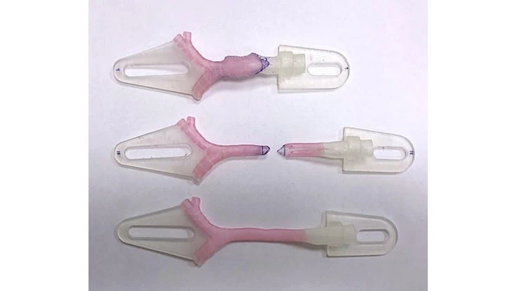 3D-printed models showing virtual surgical planning for a slide tracheoplasty procedure. Courtesy Kaalan Johnson, M.D., Seattle Children's Hospital. (Photo: Business Wire)