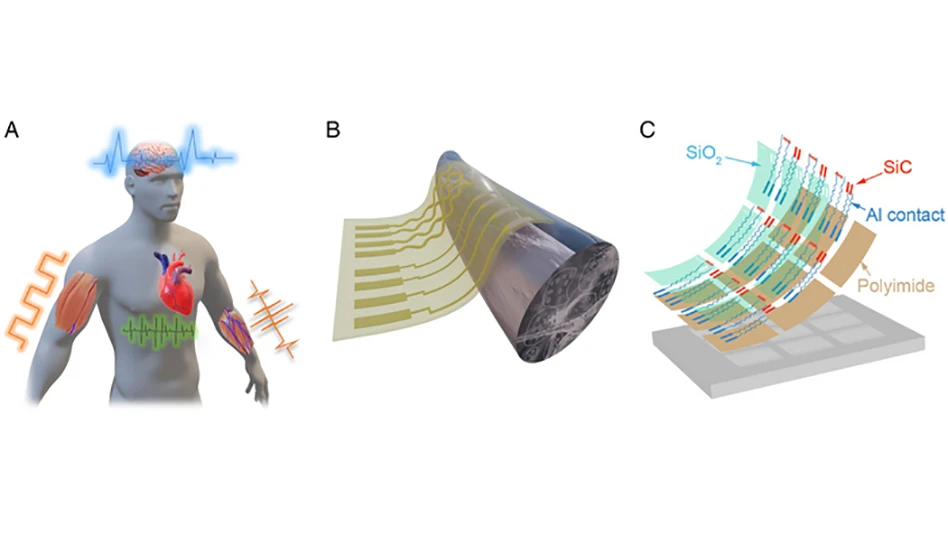 Implanted SiC electronics for the nerve stimulation protocol. (A) Concept of SiC/SiO2 electronics for neuromodulation, promoting the recovery of motor and physiological functions. (B) Schematic illustration of the flexible SiC/SiO2 wrapped around a sciatic nerve for long-term electrical stimuli and sensing. (C) Exploded view of the proposed flexible SiC/SiO2 bioelectronic system (Al: aluminum).