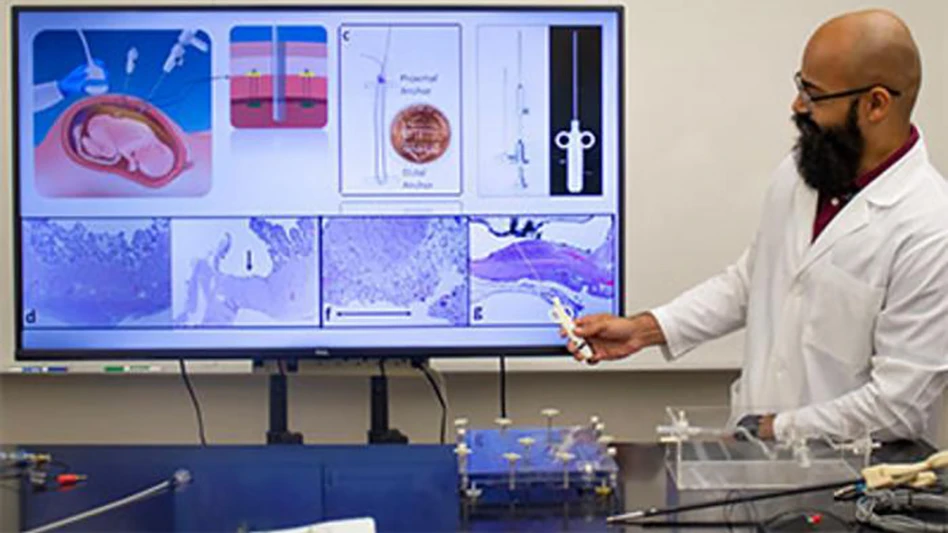 Achu Byju began working on Southwest-Midwest Pediatric Device Innovation Consortium projects as a research engineer after he graduated with his master's degree in 2016.