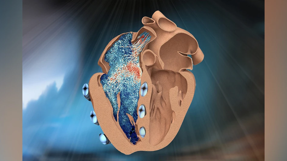 A new bio-robotic model developed by MIT engineers simulates the function of the heart’s lesser-known right ventricle (illustrated here in cross-section, as seen from a front view, on the left). Soft, balloon-like “muscles” (in blue) wrap around and contract the ventricle, mimicking its real pumping action. The model could help to test new implants and devices to treat a range of cardiac disorders.