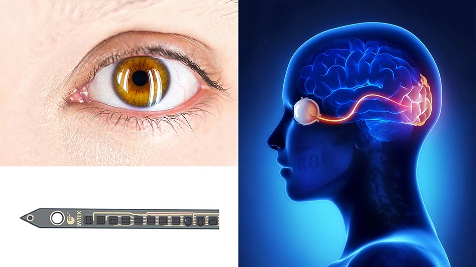 The exceptionally small vision implant created in this study uses electrical impulses to stimulate the visual cortex of the brain, where information is converted into visual impressions, like pixels on a highway matrix board.  Lower left corner: figure from the study - electrodes the size of a neuron are placed on implant “threads” as small as half a strand of hair. The implant is made of a non-corrosive material paving the way for a permanent – and more efficient - solution for the blind.