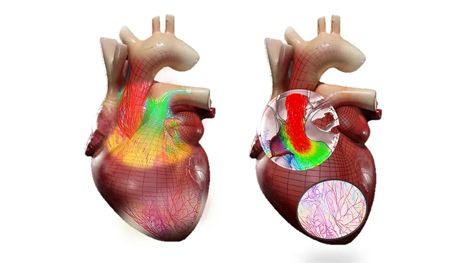 Digital twin of a heart with aortic flow